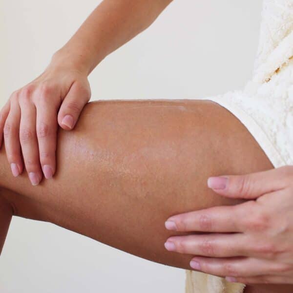 LipoREPAIR - Trattamento Anti Cellulite - immagine 4